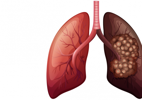 Limpe pulmões e cure sua insônia rapidamente ao fazer este chá