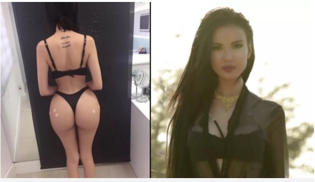 Brasileira injeta gordura no bumbum para parecer com Kim Kardashian  