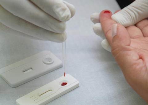 FMT oferece teste rápido de HIV e atendimento médico gratuito em ação social neste sábado