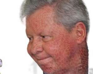 Arthur Virgílio e o poder da serpente 