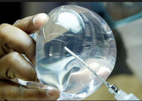 Implante de mama é associado a câncer, afirmam médicos   