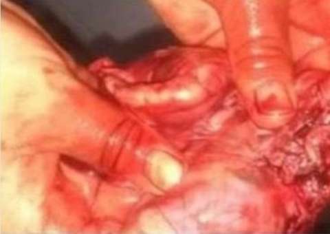 Estudante de Manaus arranca o coração de sua cadela e posta fotos nas redes sociais