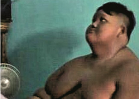 Garoto de 10 anos pesa 190 quilos por fazer dieta 'bizarra'