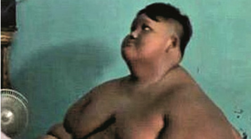 Garoto de 10 anos pesa 190 quilos por fazer dieta 'bizarra'