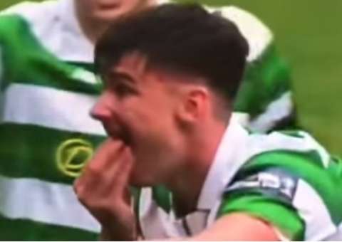 Jogador perde dois dentes após cotovelada. Veja vídeo  