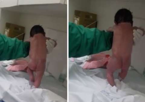  Milagre: Bebê brasileiro nasce andando e vídeo impressionante bomba na web