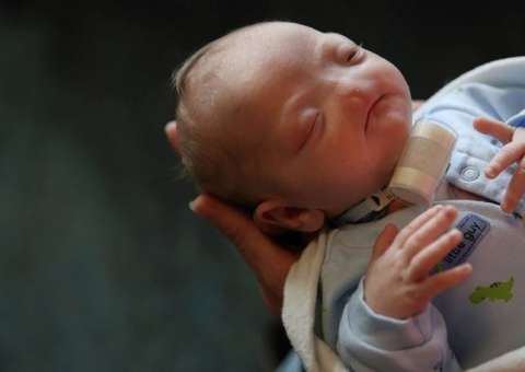 Bebê nasce com doença rara e detalhe no rosto intriga médicos