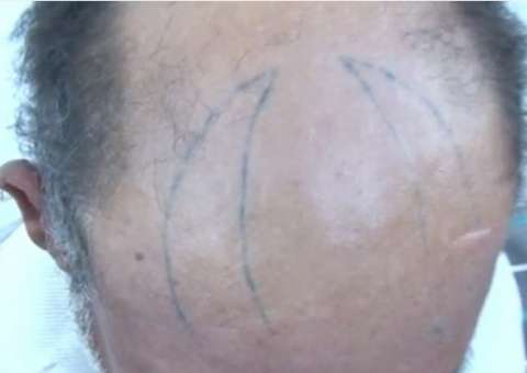 Mulher tatua chifre na cabeça do marido com ajuda de amante