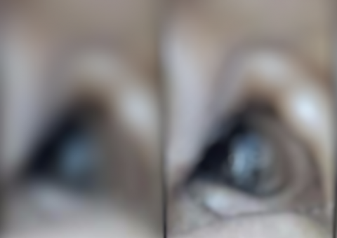  Mulher vai parar no hospital com forte dor de cabeça e algo vivo sai da sua orelha