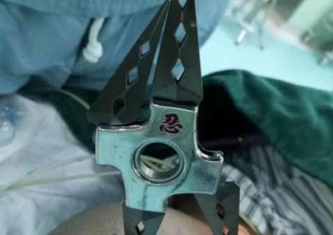 Em sala de aula, criança crava lâmina em crânio de colega