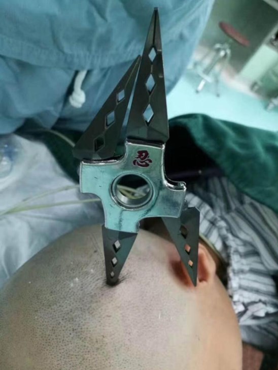 Em sala de aula, criança crava lâmina em crânio de colega