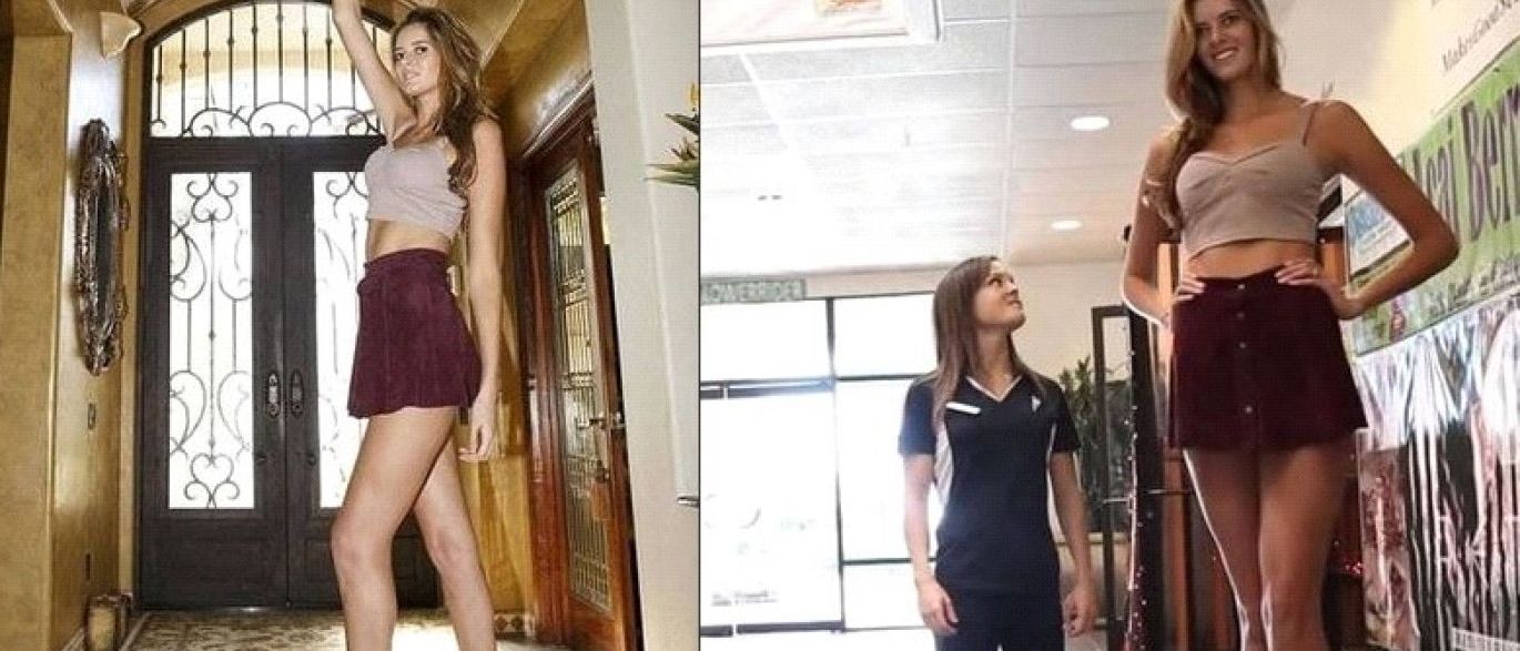 Modelo é rejeitada por agências porque tem pernas compridas demais