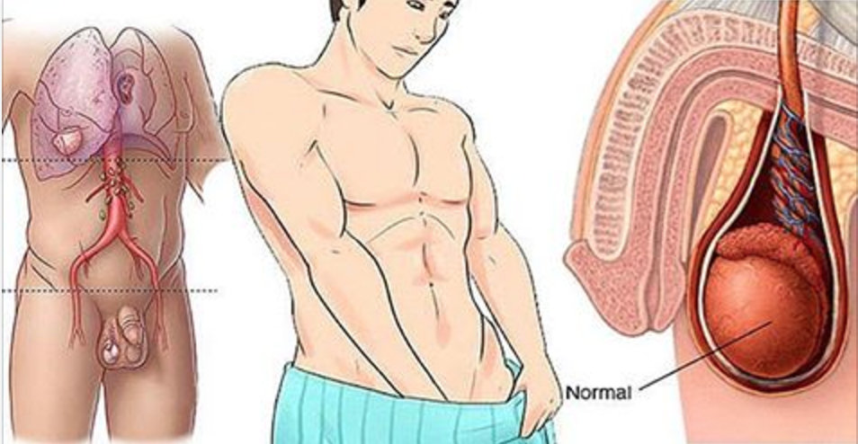 Esta é a razão pela qual muitos homens têm câncer nos testículos e não desconfiam