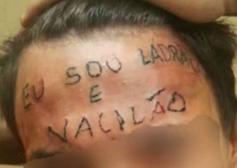 Jovem tatuado na testa se prepara para cirurgia de remoção 