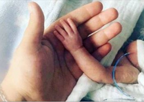 Bebê nasce com apenas 22 semanas e surpreende a medicina 