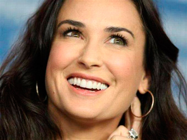 Demi Moore revela que perdeu dois dentes da frente; Veja foto
