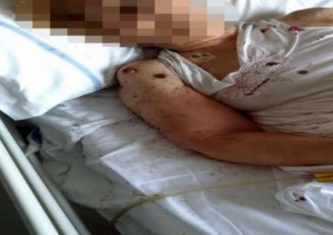 Imagem de mulher coberta por formigas em leito de hospital revolta internautas  