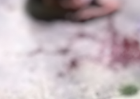 Após se fingir de morto para sobreviver a vários tiros, jovem fica cego em Manaus