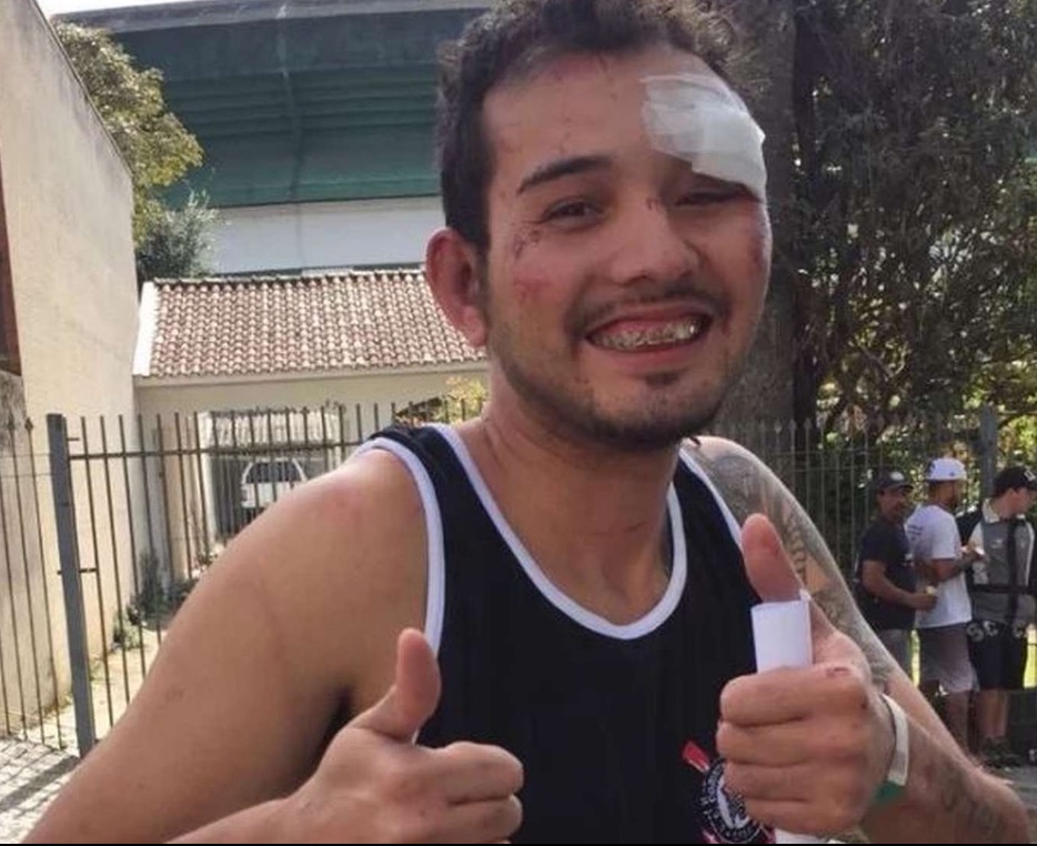 Após ser dado como morto, corintiano agredido por torcedores do Coritiba posta foto sorrindo