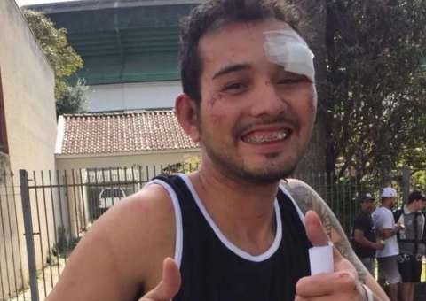 Após ser dado como morto, corintiano agredido por torcedores do Coritiba posta foto sorrindo