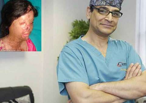 Cirurgião gasta do próprio bolso para reconstruir rostos de mulheres destruídos por ácido