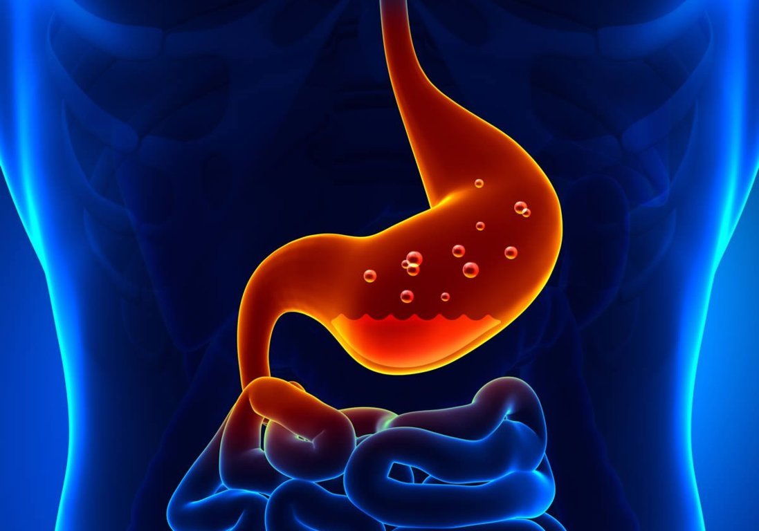 Para o fim da azia, refluxo, gastrite e úlcera com apenas 1 ingrediente