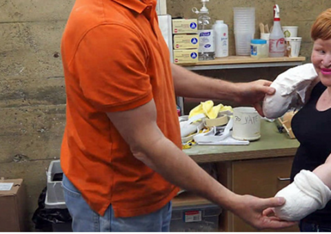 Mulher é perseguida e tem mãos cortadas pelo vizinho por ser albina 