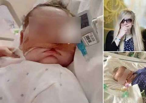 Bebê abre os olhos após Justiça mandar matá-lo ao desligar máquinas de suporte à vida
