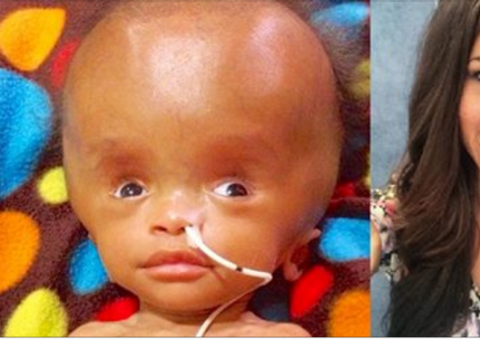 Depois de 3 anos, criança encontrada no lixo se recupera e está saudável