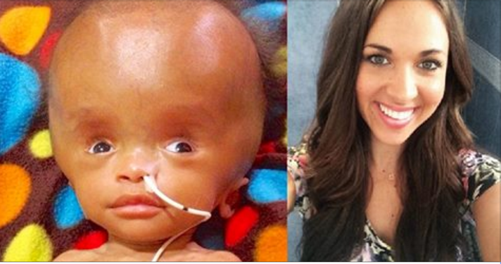 Depois de 3 anos, criança encontrada no lixo se recupera e está saudável