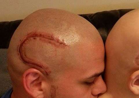 Pai que tatuou uma cicatriz para apoiar filho, recebe uma terrível notícia