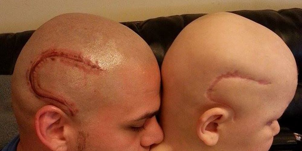 Pai que tatuou uma cicatriz para apoiar filho, recebe uma terrível notícia