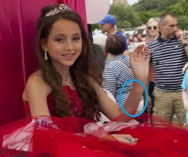 Menina de 13 anos faz tatuagem no braço e o pior acontece 