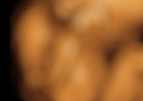 Laudo médico diz que bebê baleado na barriga da mãe está paraplégico