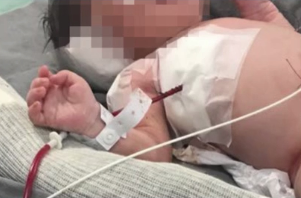 Bebê baleado na barriga da mãe no Rio, está paraplégico