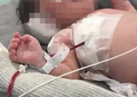 Bebê baleado na barriga da mãe no Rio, está paraplégico