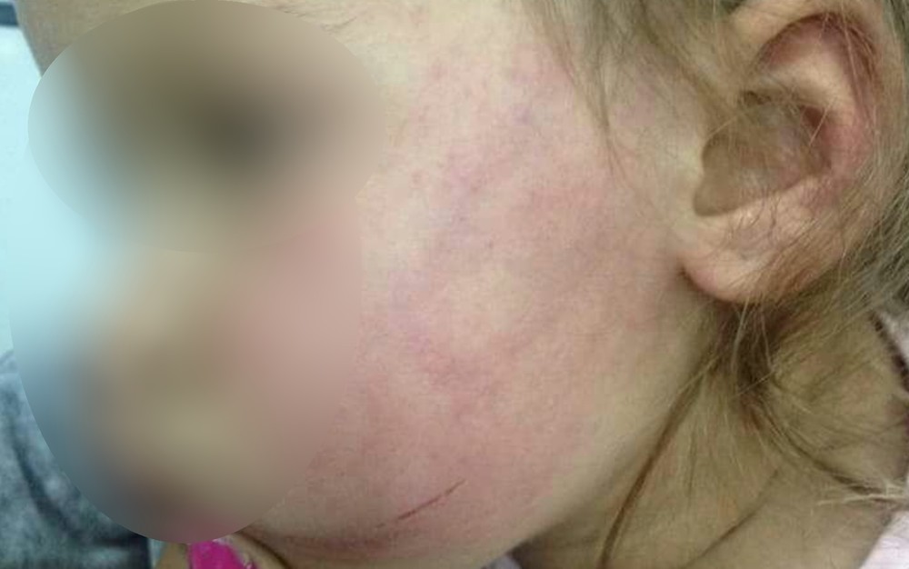 Madrasta confessa ter agredido enteada de 2 anos por ciúmes do marido