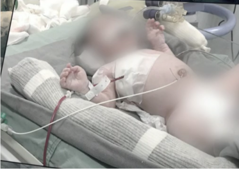 Bebê baleado na barriga da mãe pode não ficar paraplégico, segundo neurologista 