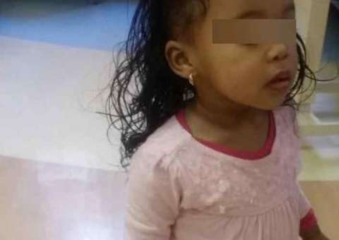 Mãe sente cheiro podre em filha de 18 meses e fica chocada ao descobrir o motivo