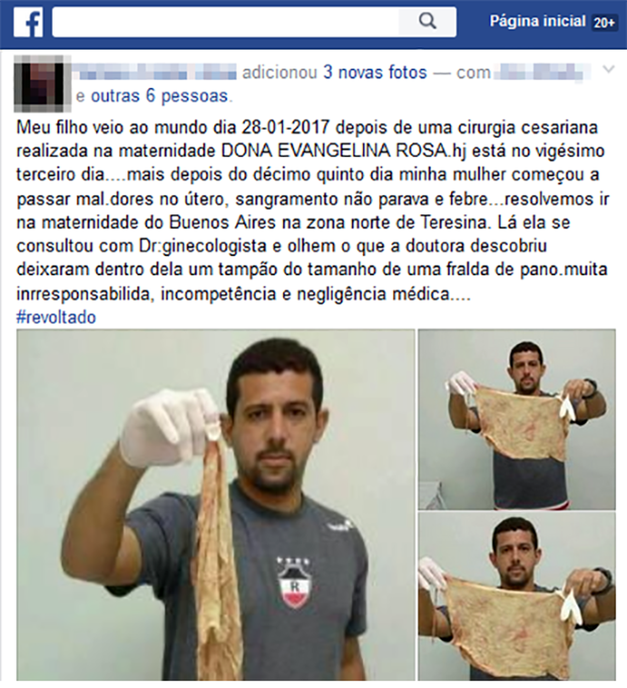 Defensoria pede indenização de R$ 100 mil por paciente ficar com tecido no canal vaginal por 20 dias