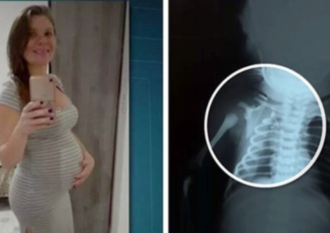 Bebê baleado quando estava no útero pode ter salvo vida da mãe