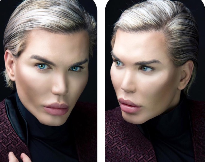 Respirando pela boca, nariz de Ken Humano brasileiro pode cair após nova cirurgia