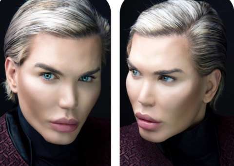 Respirando pela boca, nariz de Ken Humano brasileiro pode cair após nova cirurgia