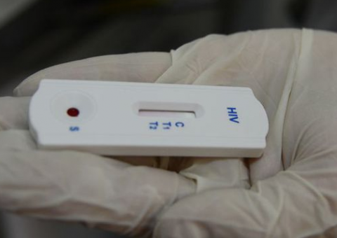 Autoteste de HIV estará disponível até o fim de julho em farmácias