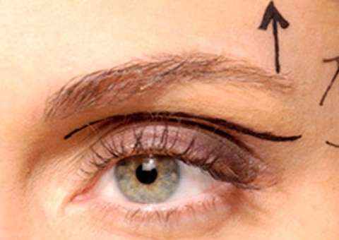 Elimine pálpebras caídas com esse tratamento natural