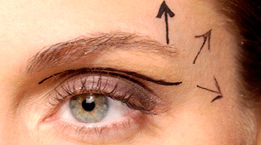 Elimine pálpebras caídas com esse tratamento natural