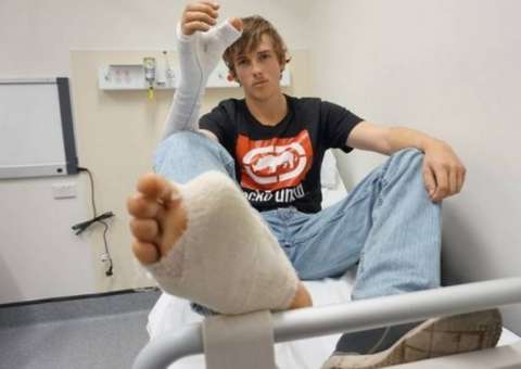 Jovem com polegar da mão decepado teve que passar por cirurgia inusitada