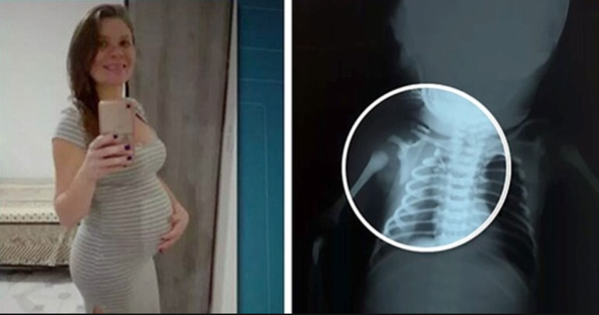 Perícia conclui que tiro que atingiu bebê no útero partiu de traficantes