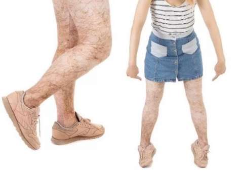 Após maiô realista, empresa lança legging 'peluda' e choca internautas