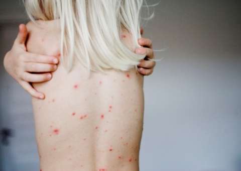 Caldo de cebola e alcachofra que pode curar  a sifilis 